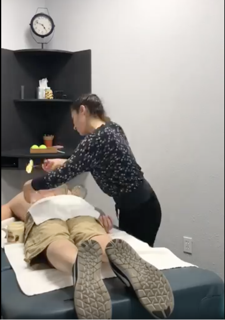 Fire Cupping Therapy in Vallejo